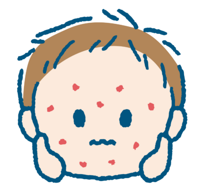 じんましんのイラスト