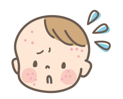 湿疹のイラスト
